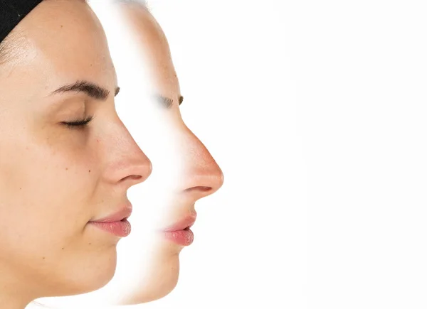 白い背景に形成手術前後の女性の鼻の比較 — ストック写真