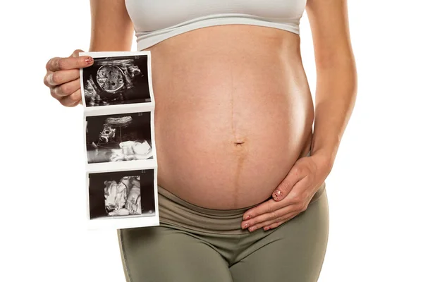 Kobieta Ciąży Obrazami Usg Białym Tle — Zdjęcie stockowe