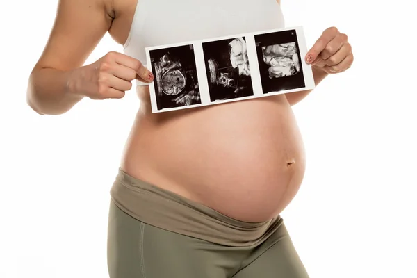 Zwangere Vrouw Met Echografie Scan Foto Een Witte Achtergrond — Stockfoto