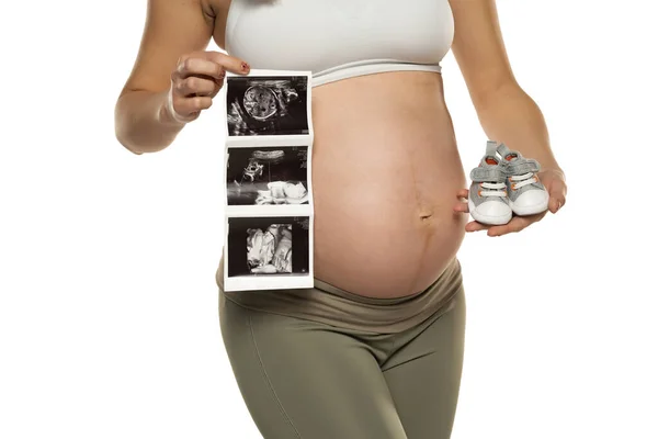 Kobieta Ciąży Zdjęciami Usg Parą Szarych Adidasów Białym Tle — Zdjęcie stockowe
