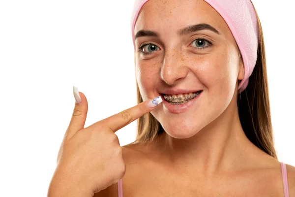 Happy Girl Pointing Her Dental Braces White Background — Stok Foto