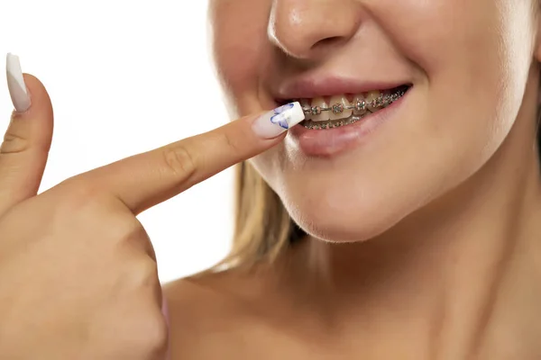 Menina Feliz Apontando Seus Aparelhos Dentários Fundo Branco — Fotografia de Stock