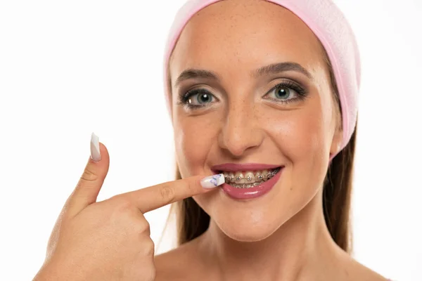Happy Girl Pointing Her Dental Braces White Background — Foto de Stock