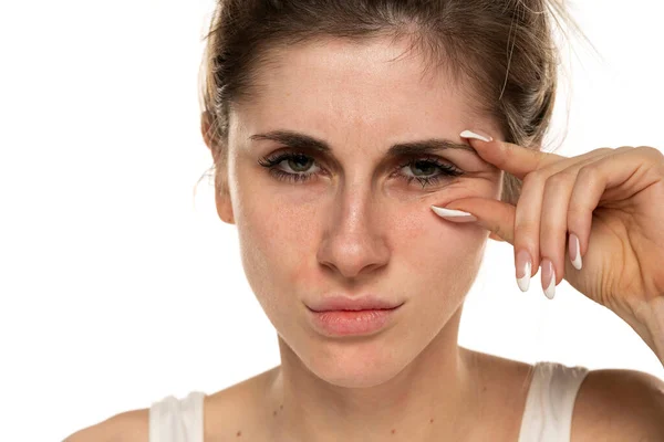 Mujer Joven Mostrando Sus Arrugas Oculares Con Los Dedos Sobre — Foto de Stock