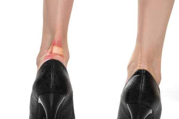 Closeup Woman Heel Blister Plaster White — Stock Photo, Image