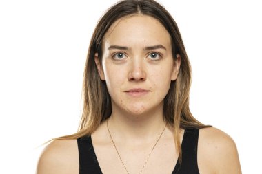 Makyajsız güzel bir kadının portresi ve beyaz arka planda sorunlu bir ten.