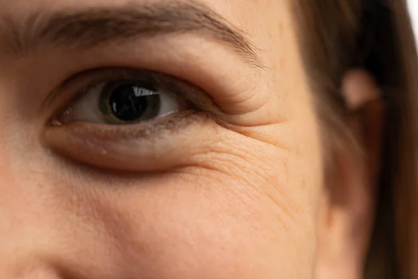 Young Caucasian Women Eye Wrinkles Closeup Isolated White Background — Stock Photo, Image