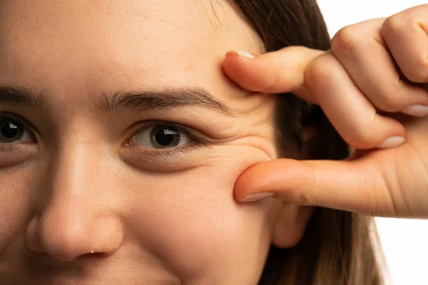 Young Woman Showing Her Eye Wrinkles Her Fingers White Background — Stock Photo, Image