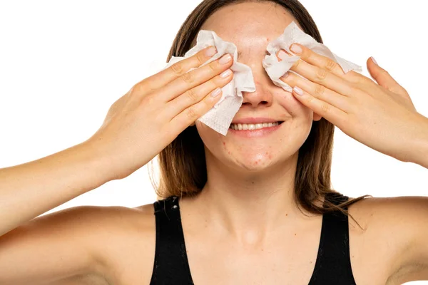 Young Smiling Woman Cleans Her Face Wet Tissue White Background — Foto de Stock