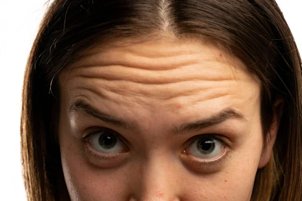Young Woman Showing Her Forehead Wrinkles White Background — Stock fotografie