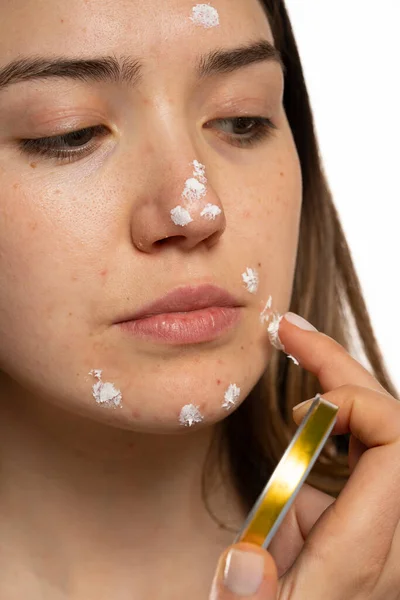 Woman applying acne cream on her face for solving acne inflammation on her face on a white background