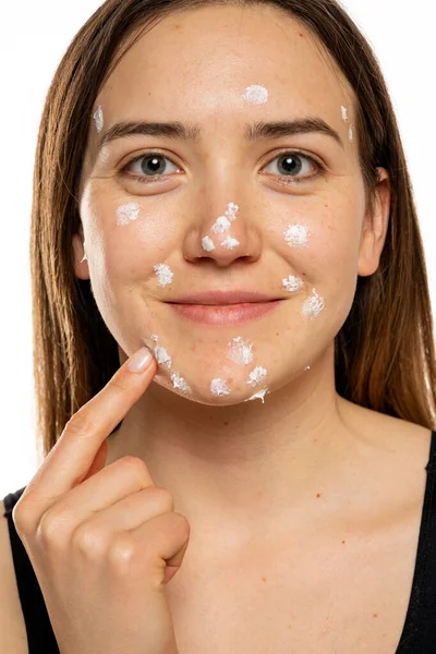 Smiling Woman Applying Acne Cream Her Face Solving Acne Inflammation — Stock Fotó