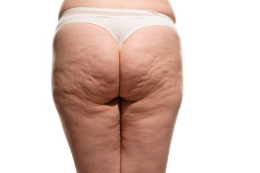 Overweight woman with fat cellulite legs and buttocks, obesity female body, white background. clipart
