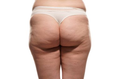 Overweight woman with fat cellulite legs and buttocks, obesity female body, white background.