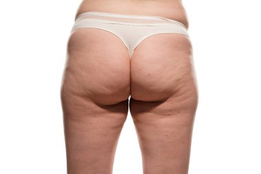 Overweight woman with fat cellulite legs and buttocks, obesity female body, white background.