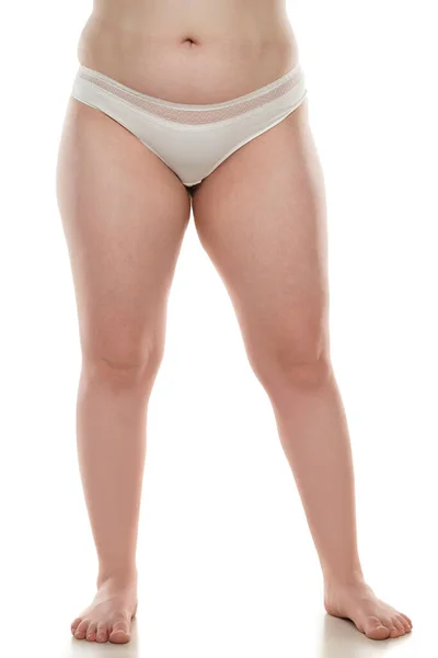 Front View Overweight Woman Fat Cellulite Legs Belly Obesity Female — Stockfoto