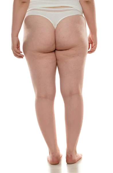 Overweight Woman Fat Cellulite Legs Buttocks Obesity Female Body White — Stock Photo, Image