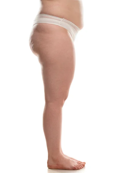 Side View Overweight Woman Fat Cellulite Legs Belly Buttocks Obesity — Stockfoto