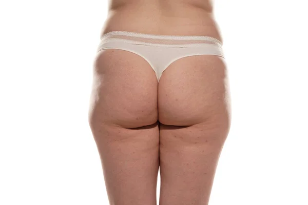 Overweight Woman Fat Cellulite Legs Buttocks Obesity Female Body White — Zdjęcie stockowe