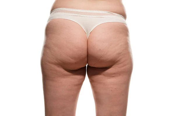 Overweight Woman Fat Cellulite Legs Buttocks Obesity Female Body White — Photo