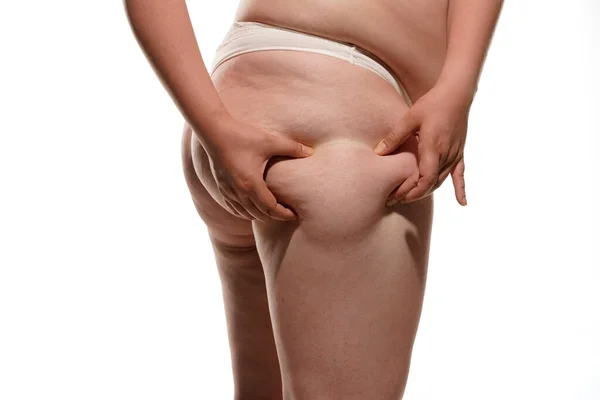 Şişman Selülit Bacakları Kalçaları Olan Şişman Bir Kadın Beyaz Arka — Stok fotoğraf
