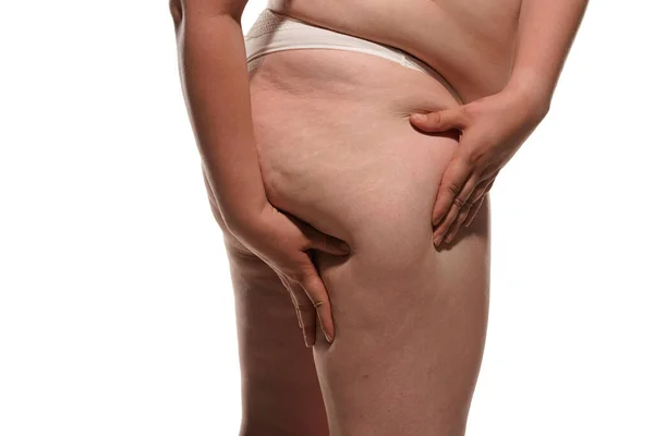 Şişman Selülit Bacakları Kalçaları Olan Şişman Bir Kadın Beyaz Arka — Stok fotoğraf