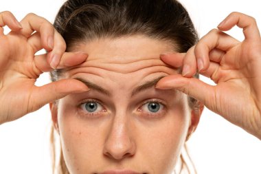 Studio shot of a beautiful young woman with blue eyes, pinching the skin on her forehead isolated on white.
