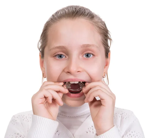 Mädchen zieht sich für kieferorthopädische Behandlung eine Zahnspange an — Stockfoto