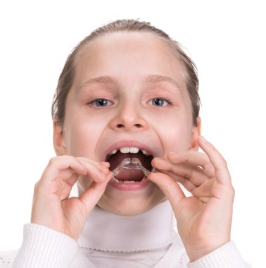 Girl putting on medical braces for orthodontic treatment clipart