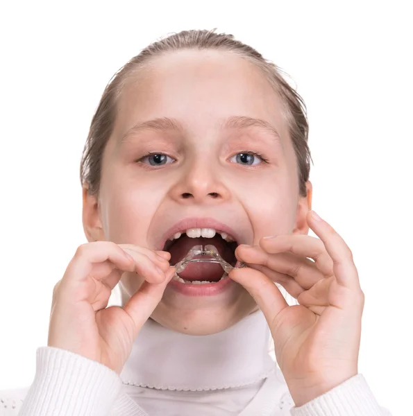 Girl putting on medical braces for orthodontic treatment — Stock Photo, Image