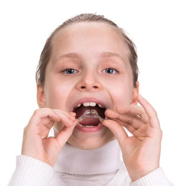 Chica poniendo aparatos médicos para el tratamiento de ortodoncia — Foto de Stock