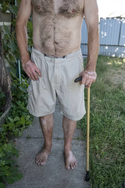 Seniot Homem Com Uma Cana Posando Jardim — Fotografia de Stock