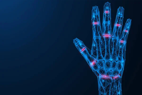 Inflammation Pain Joints Hand Polygonal Design Interconnected Lines Points Blue — 图库矢量图片