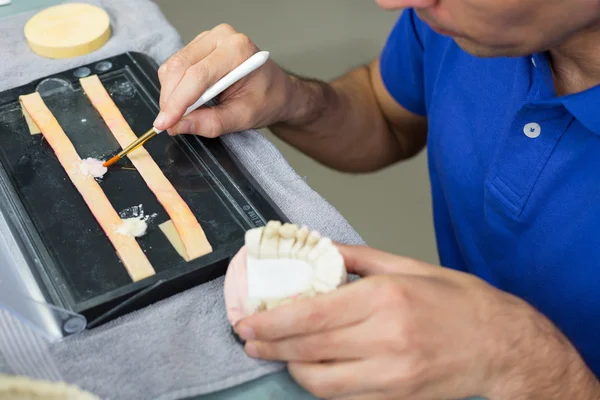 Primo piano del dentista che applica porcellana — Foto Stock