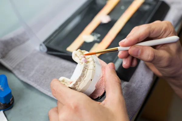 Fecho do técnico odontológico aplicando porcelana — Fotografia de Stock