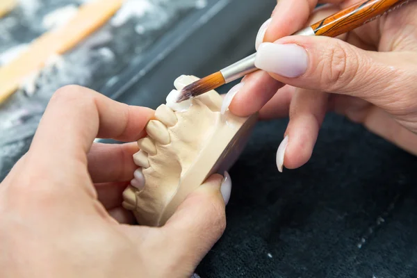 Технік в стоматологічній лабораторії нанесення кераміки на протез — стокове фото