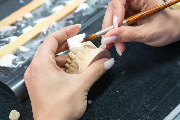 Tecnico in un laboratorio odontoiatrico che applica la ceramica a una protesi — Foto Stock