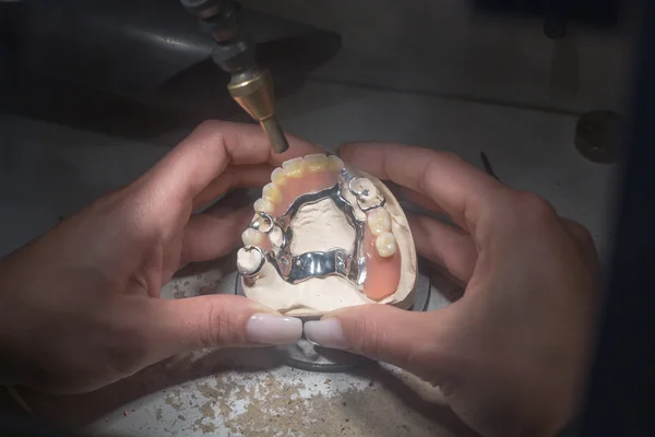 Technician in a dental lab producing a prosthesis using a laser device — Stock Photo, Image