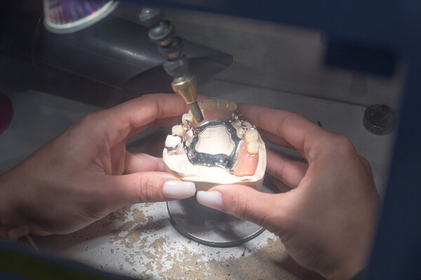 Technician in a dental lab producing a prosthesis using a laser device