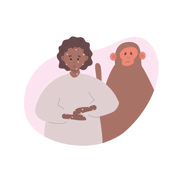 Ilustração Vetorial Uma Mulher Com Varíola Macaco Gráficos De Vetores