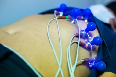 Elektrokardiyogram hastanede kalp ve nabız ölçümü için. Yıllık sağlık kontrolü. Ölçüm hastaların kan basıncı elektrokardiyografi hemşire. EKG