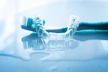 Modern görünmez parantez hizalayıcıları dişçiler tarafından dişlerin hizalanmasını düzeltmek için kullanılır.