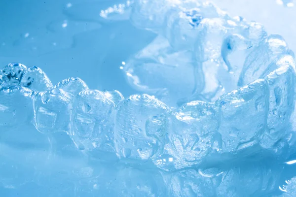 Modern görünmez parantez hizalayıcıları dişçiler tarafından dişlerin hizalanmasını düzeltmek için kullanılır.