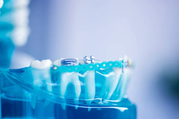 Uchwyt Osiowania Zębów Stomatologicznych Ucznia Model Pokazujący Dziąsła Prostownice Zębów — Zdjęcie stockowe