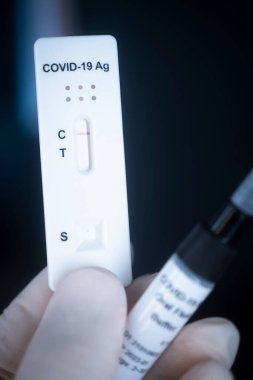 Negatif covid 19 Corona virüsü antikor test sonuçları