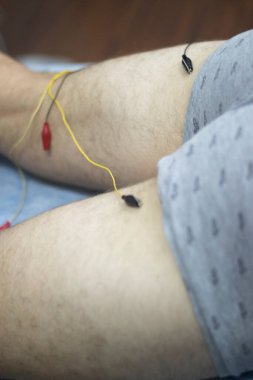 EPI Doku İçi Perkütan Elektroliz Kuru iğneler Fiziksel Tedavi.