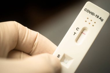 Covid 19 virüs salgını test sonuçları evde salya çıkmadı..