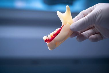 Diş çürüğü, diş eti, diş eti ve kanal tedavisi.