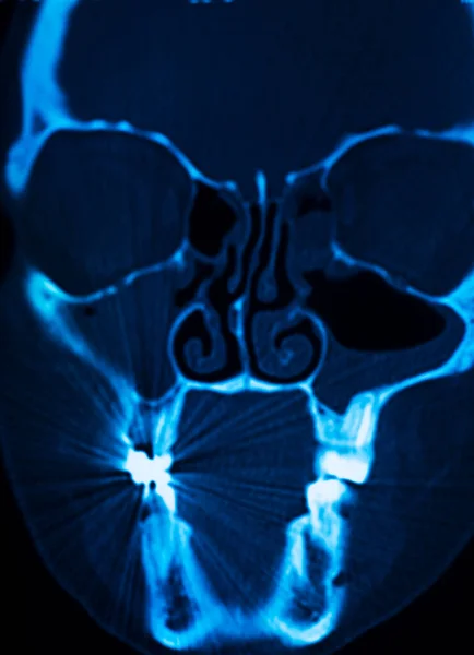 Медичний Огляд Рентгенівського Сканування Черепа Носа Результати Медичного Огляду Клініки — стокове фото