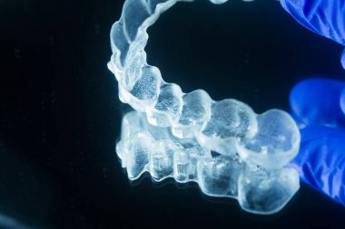 Modern görünmez parantez hizalayıcıları dişçiler tarafından dişlerin hizalanmasını düzeltmek için kullanılır.